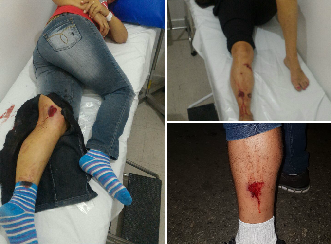 Muitos feridos, após a polícia atirar bombas de efeito moral contra apoiadores de Lula