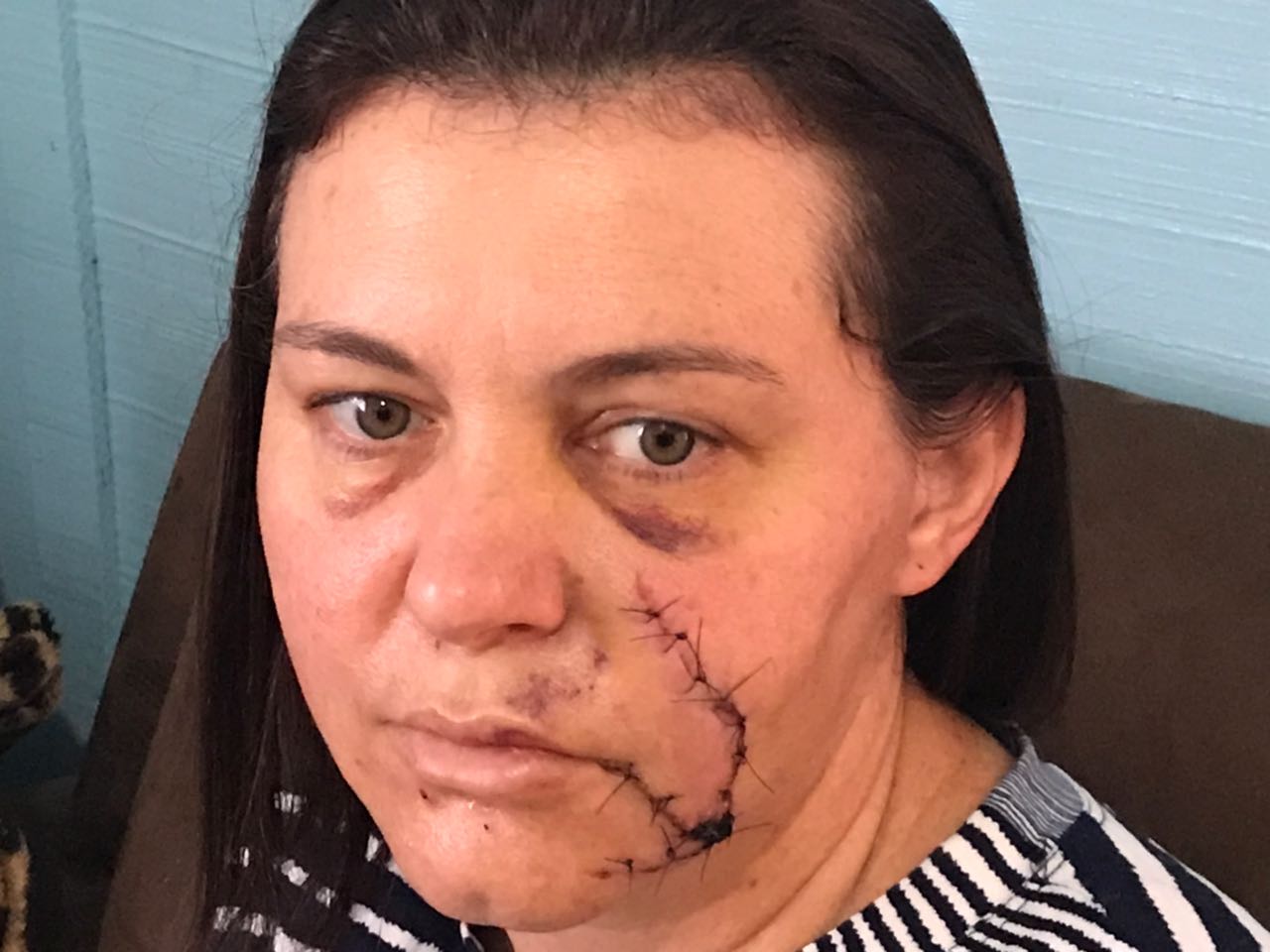 Violência contra a mulher é feio para quem pratica: Roseli Cecatto fala sobre a tentativa de feminicídio que sofreu